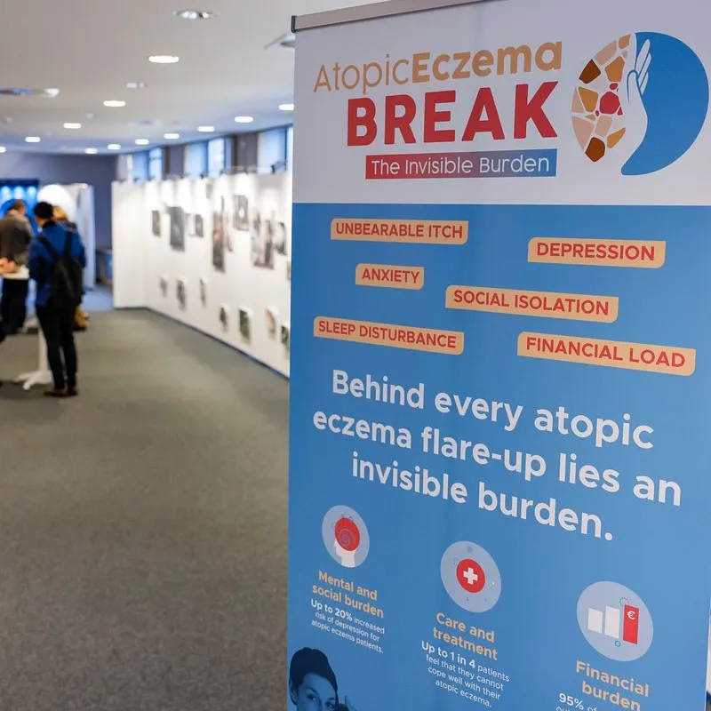 Exhibition signage and visual identity designed for the Atopical Lives exhibition at the European Parliament, part of EFA's Break the Invisible Burden awareness campaign on atopic eczema.